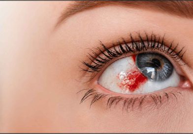 Arakeshwar Ras – Ayurvedic Benefits, Uses & Key Ingredients Hemorrhagic-Disorders