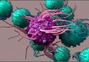 What Is Dendritic Cell Therapy for Cancer?-How Ayurveda Can Help dendritic-cell