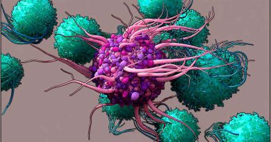 What Is Dendritic Cell Therapy for Cancer?-How Ayurveda Can Help dendritic-cell