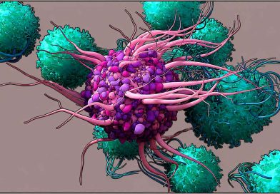 What Is Dendritic Cell Therapy for Cancer?-How Ayurveda Can Help dendritic-cell