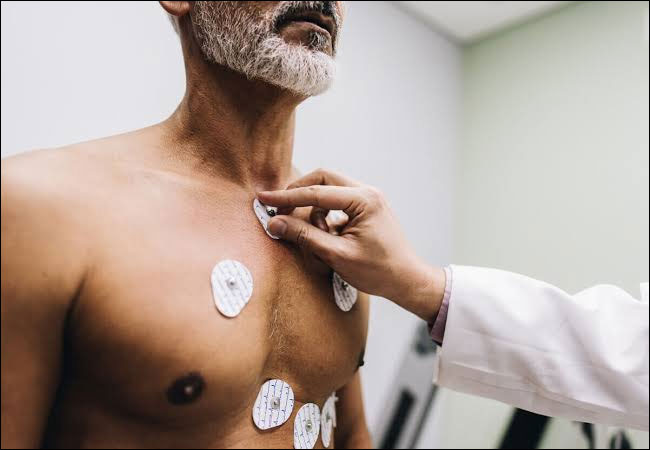 Nuclear Cardiac Stress
