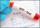 Alpha-Fetoprotein (AFP) Test – Meaning, Normal Levels & Liver Health Alpha-fetoprotein-Test-