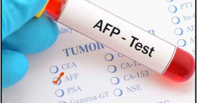 Alpha-Fetoprotein (AFP) Test – Meaning, Normal Levels & Liver Health Alpha-fetoprotein-Test-