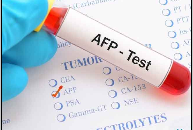 Alpha-fetoprotein-Test-