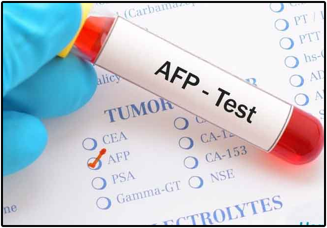 Alpha-fetoprotein-Test Alpha-fetoprotein-Test