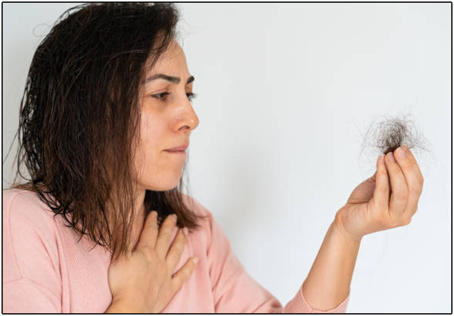 Hair Loss