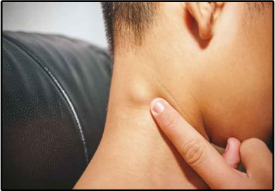 Lymphoid Tumor – Ayurvedic Support, Causes, Symptoms & Treatment Lymphoid Tumor – Ayurvedic Support, Causes, Symptoms & Treatment